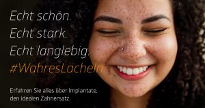 Implantate Lächeln Frau